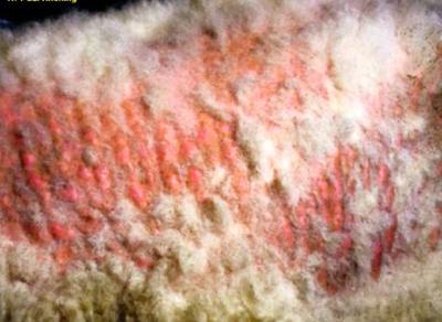 White Vaginal Discharge During Pregnancy Should You Be Worried