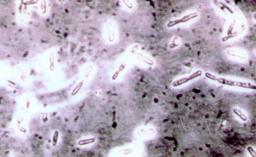 bio pesticide bt bacillus thuringiensis infonet biovision home